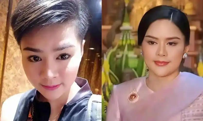  那个总被嘲笑“香肠嘴”的国王，其实藏着三十年的容貌心结 情感心理